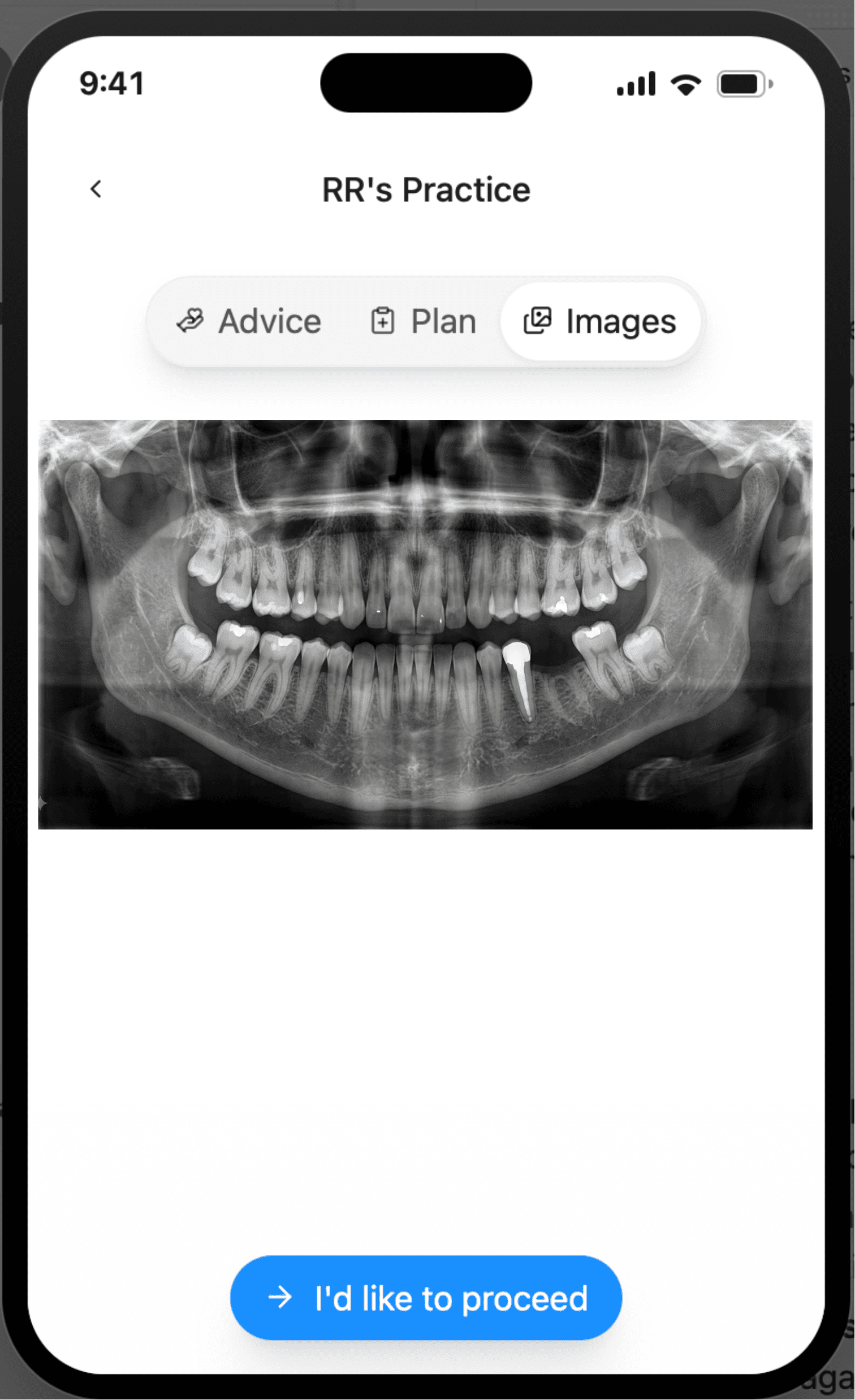 CoTreat Patient Care Pack mobile interface Images tab showing the patient's own panoramic radiograph, with the implant already placed at the missing lower left first molar site, alongside a button to indicate the patient would like to proceed. Demonstrates giving patients direct, understandable access to their own imaging alongside the consultation letter.