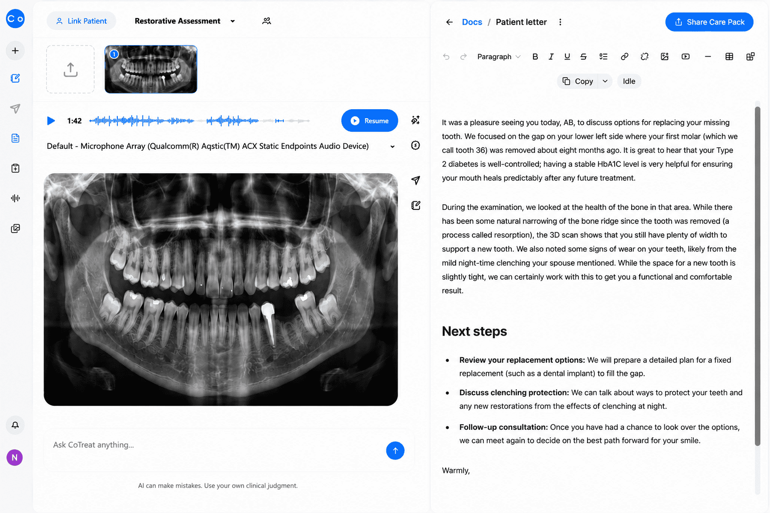 CoTreat Chairside patient letter editor showing an AI-generated letter for an implant consultation explaining, in plain language, the missing lower left first molar, the patient's well-controlled Type 2 diabetes, CBCT-confirmed bone width despite ridge resorption, and next steps of reviewing implant replacement options and discussing protection against nocturnal clenching. Demonstrates AI-assisted patient communication translating implant candidacy findings into understandable language.