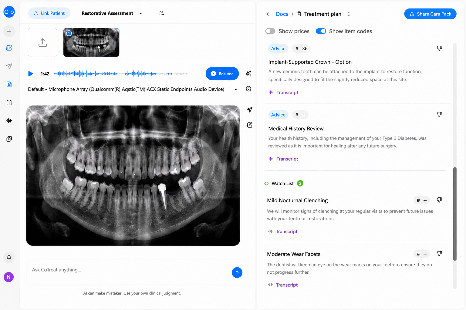 CoTreat Chairside treatment plan interface displaying AI-generated advice items for an implant case, including an implant-supported crown option sized to a slightly reduced restorative space, a medical history review noting the patient's Type 2 diabetes control ahead of future surgery, and a watch list flagging mild nocturnal clenching and moderate wear facets for ongoing monitoring. Demonstrates how clinical findings are translated into a documented, patient-specific implant treatment plan.