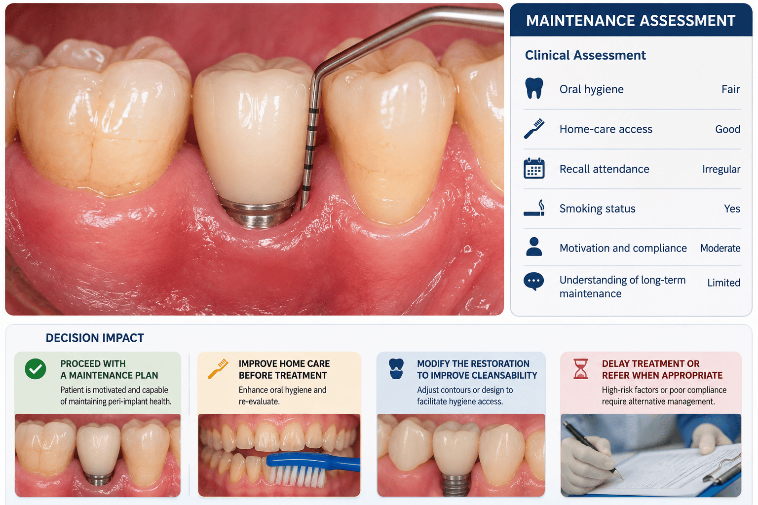 Clinical photograph of an implant-supported crown being probed alongside a maintenance assessment summary rating oral hygiene as fair, home-care access as good, recall attendance as irregular, and smoking status as yes, with decision-impact options to proceed with a maintenance plan, improve home care, modify the restoration for cleansability, or delay treatment. Demonstrates how maintenance capacity findings are converted into a management pathway for implant candidacy.