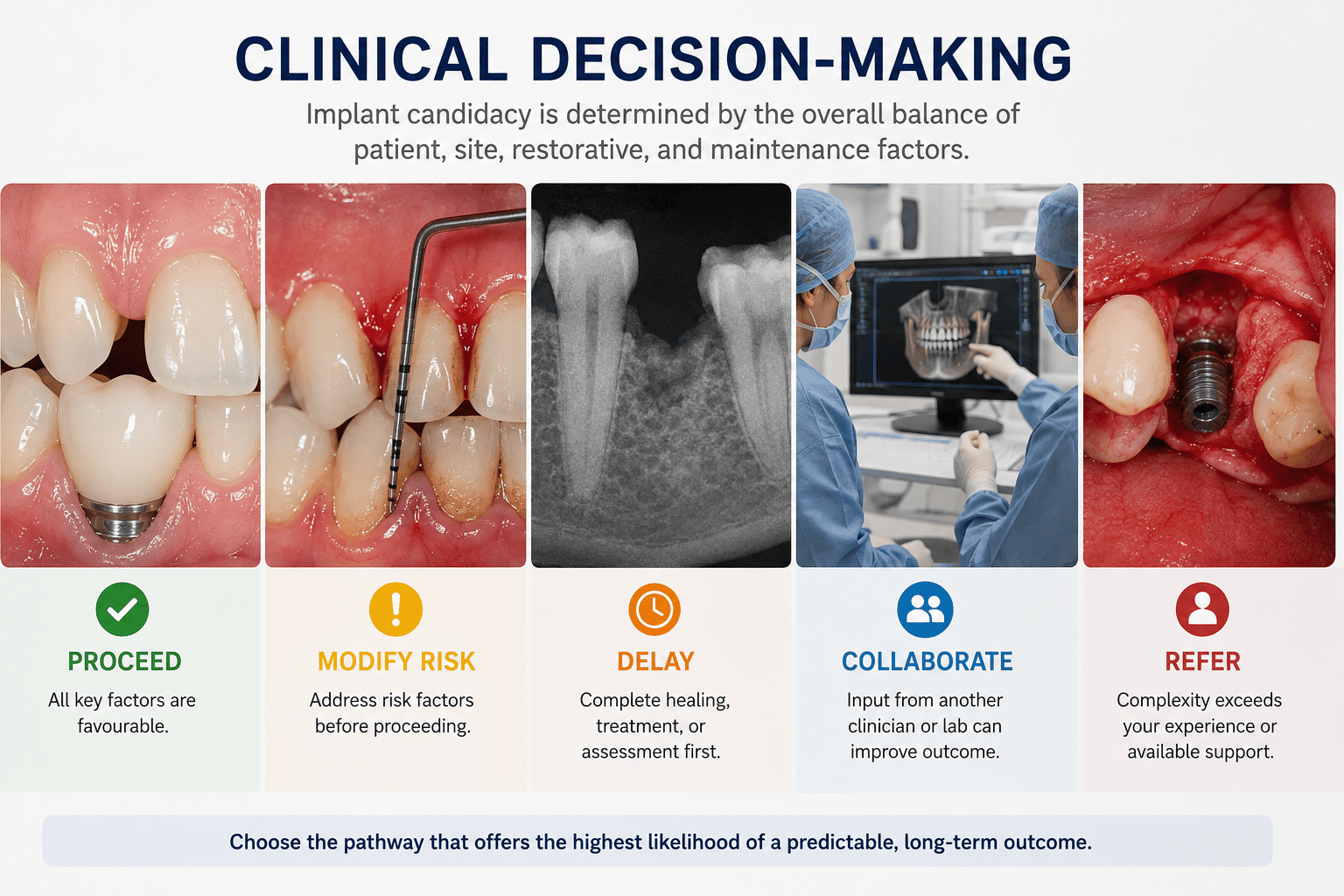 Clinical decision-making flowchart for implant treatment showing five management pathways: proceed when all key factors are favourable, modify risk by addressing risk factors before proceeding, delay to complete healing or assessment first, collaborate for input from another clinician or laboratory, and refer when complexity exceeds the clinician's experience or available support. Illustrates choosing the pathway most likely to achieve a predictable, long-term implant outcome.