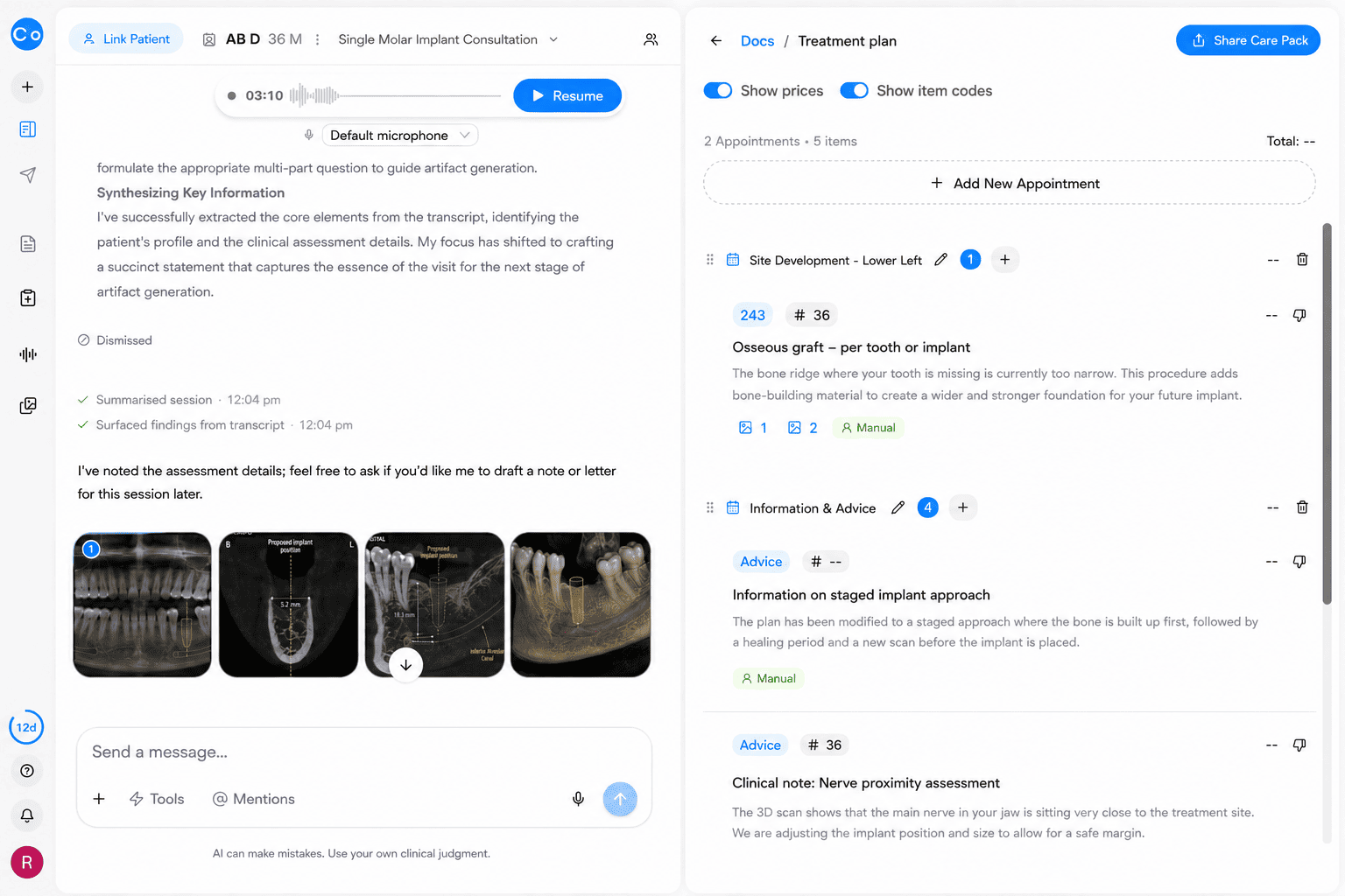CoTreat Chairside treatment plan interface displaying AI-generated advice items for an implant case, including a site-development appointment for an osseous graft to widen the deficient ridge, a note on the staged implant approach where the graft heals before a new scan and implant placement, and a clinical note flagging inferior alveolar nerve proximity requiring an adjusted implant position and size. Demonstrates how CBCT findings are translated into a documented, staged implant treatment plan.