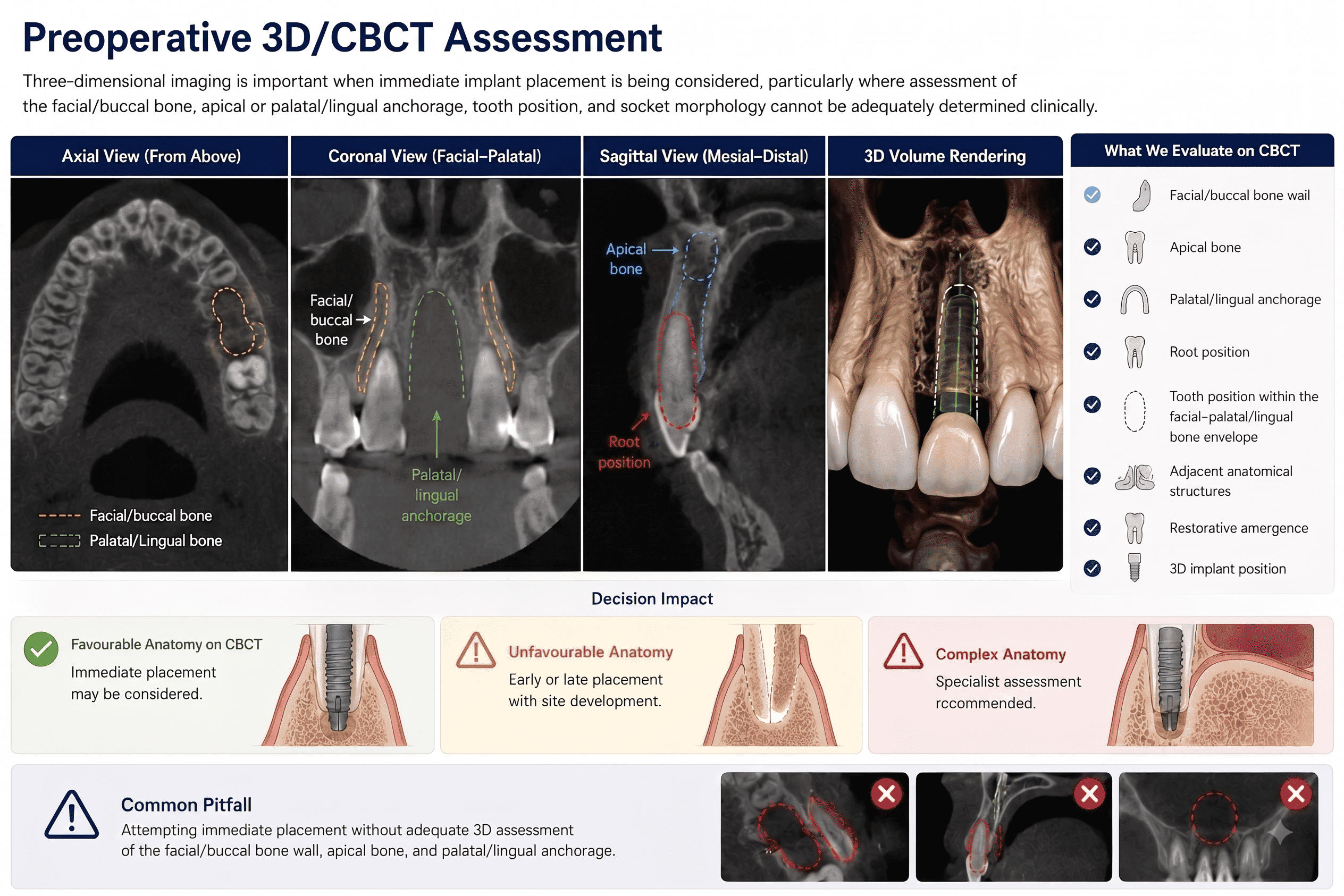 Four-panel CBCT assessment of an anterior extraction site showing axial, coronal, and sagittal views with the facial/buccal bone, palatal/lingual anchorage, apical bone, and root position labelled, alongside a 3D volume rendering of the planned implant, and a checklist of what to evaluate on CBCT including facial/buccal bone wall, apical bone, palatal/lingual anchorage, root position, tooth position within the bone envelope, adjacent structures, restorative emergence, and 3D implant position.