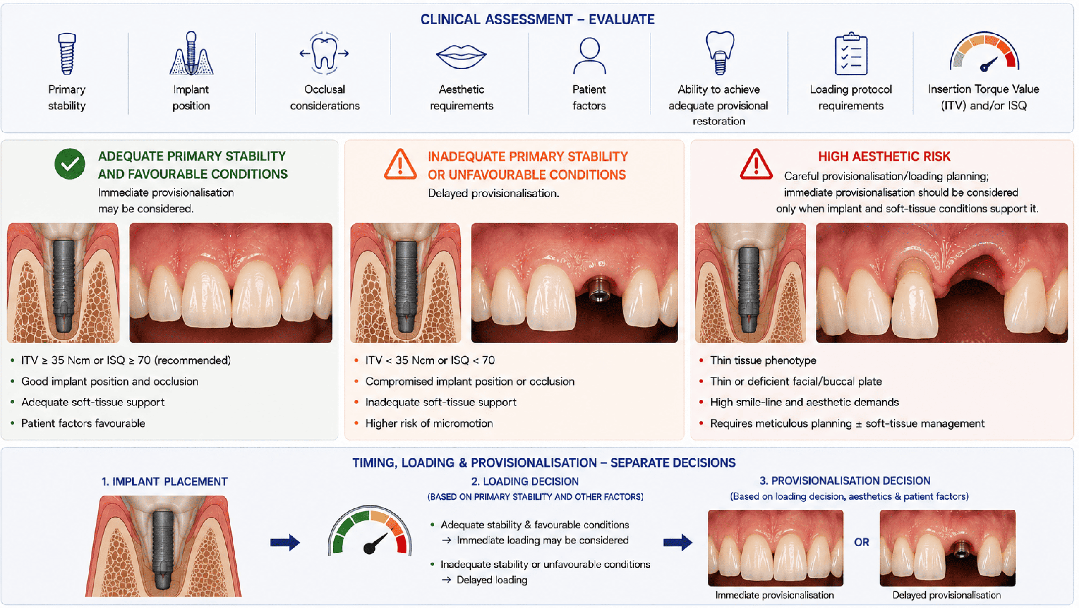 Three-column decision panel showing adequate primary stability and favourable conditions supporting immediate provisionalisation, inadequate primary stability or unfavourable conditions requiring delayed provisionalisation, and high aesthetic risk requiring careful provisionalisation planning, alongside a three-step flow separating implant placement, the loading decision based on primary stability, and the provisionalisation decision based on loading, aesthetics, and patient factors.