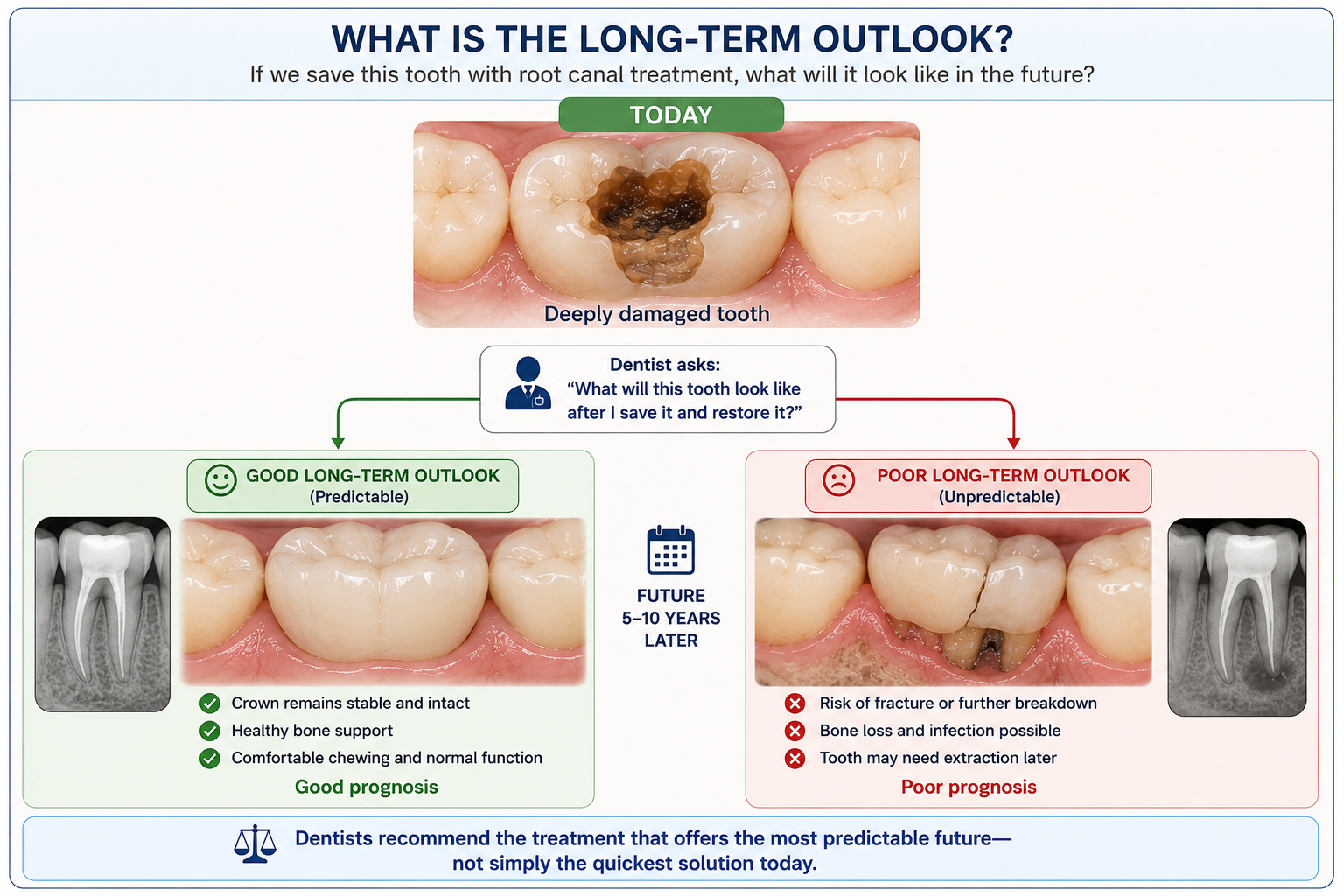 Long-term outlook — comparing the tooth's condition today with its expected outcome years later