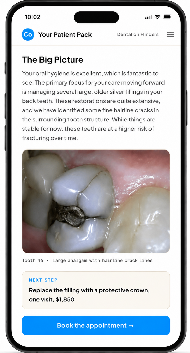 CoTreat patient pack showing tooth 46 with a large amalgam filling and hairline crack lines, with a next step of replacing the filling with a protective crown