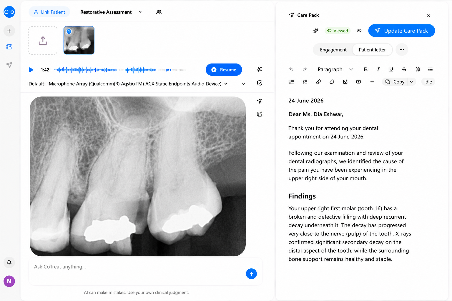 CoTreat Chairside patient communication interface generating a personalized dental care letter from clinical findings, radiographs, and AI-assisted documentation. The system automatically explains the diagnosis, radiographic findings, treatment recommendations, and clinical reasoning in patient-friendly language following a restorative assessment. Demonstrates AI-powered patient communication, automated care pack generation, chairside documentation, and personalized treatment planning for restorative and endodontic care.