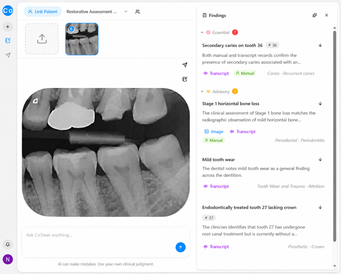 Secondary caries clinical image