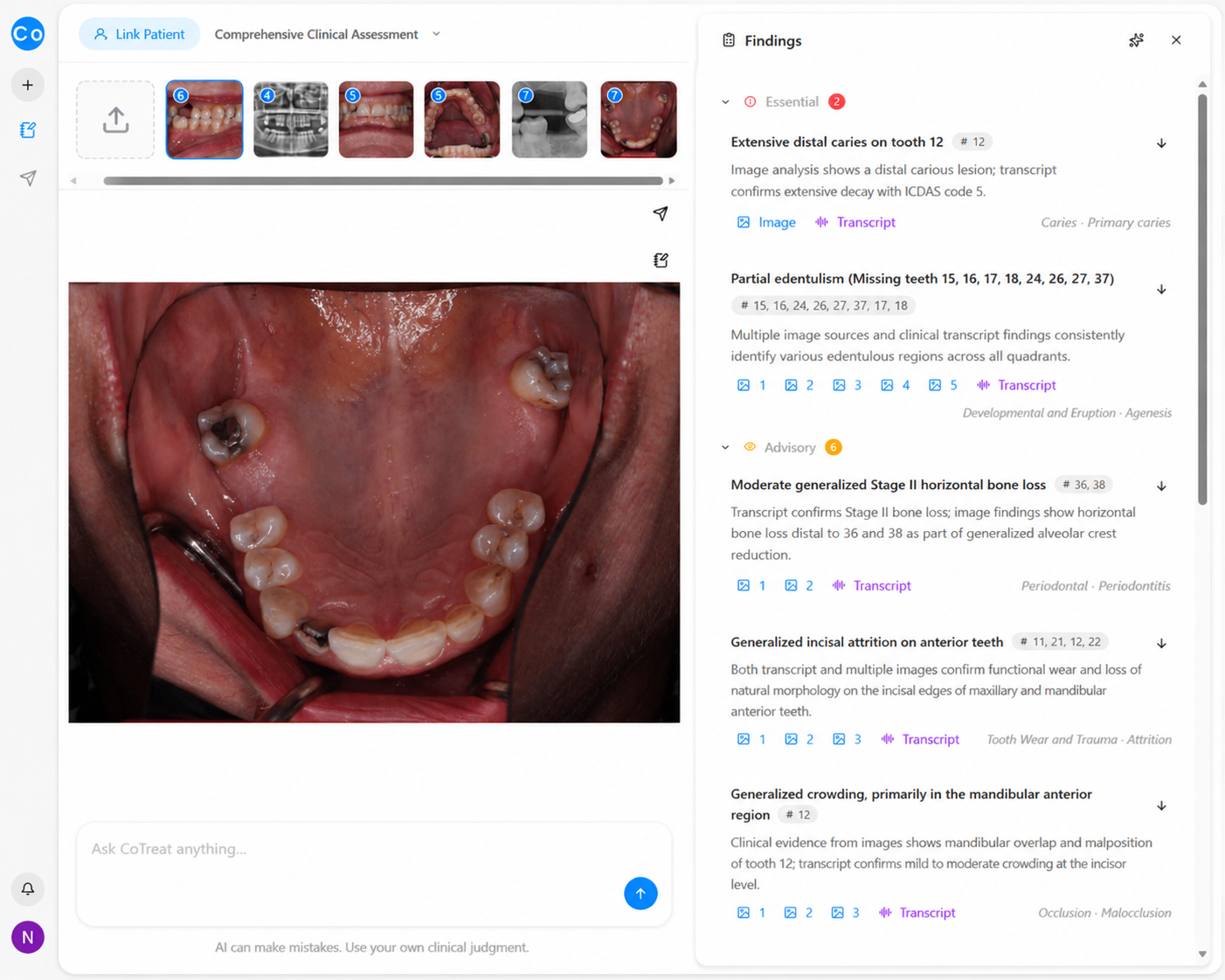 Tooth loss clinical image